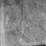Wandgemäldezyklus IV, zwei Standfiguren mit Spruchbändern